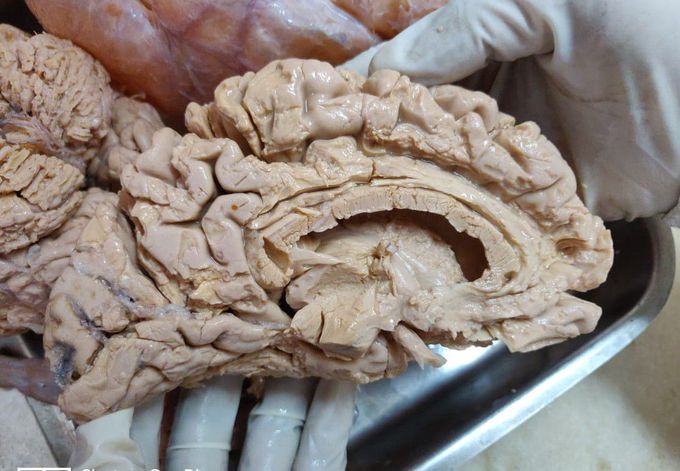 Brain.game