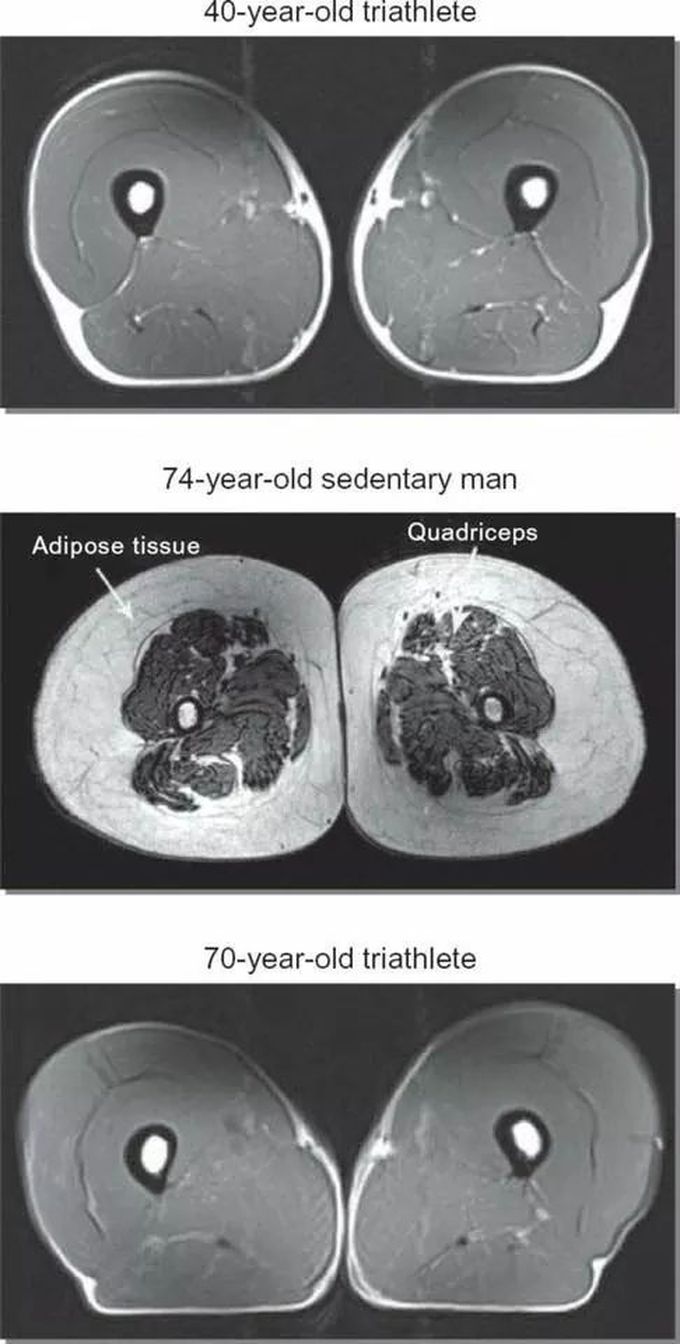 Differences in muscle mass