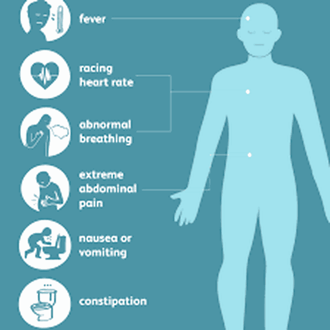 Symptoms of peritonitis