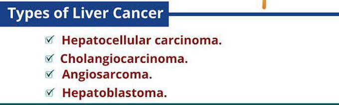 Types of liver cancer