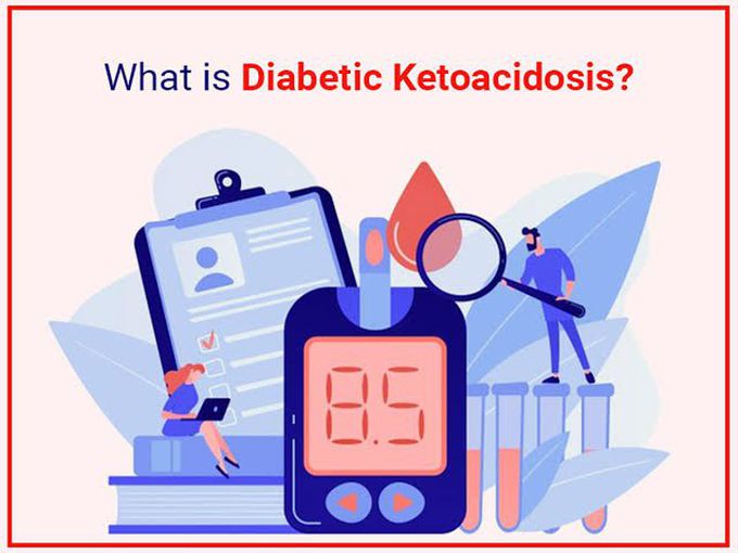 Diabetic ketoacidosis