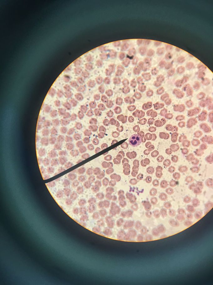 A smiling neutrophil !