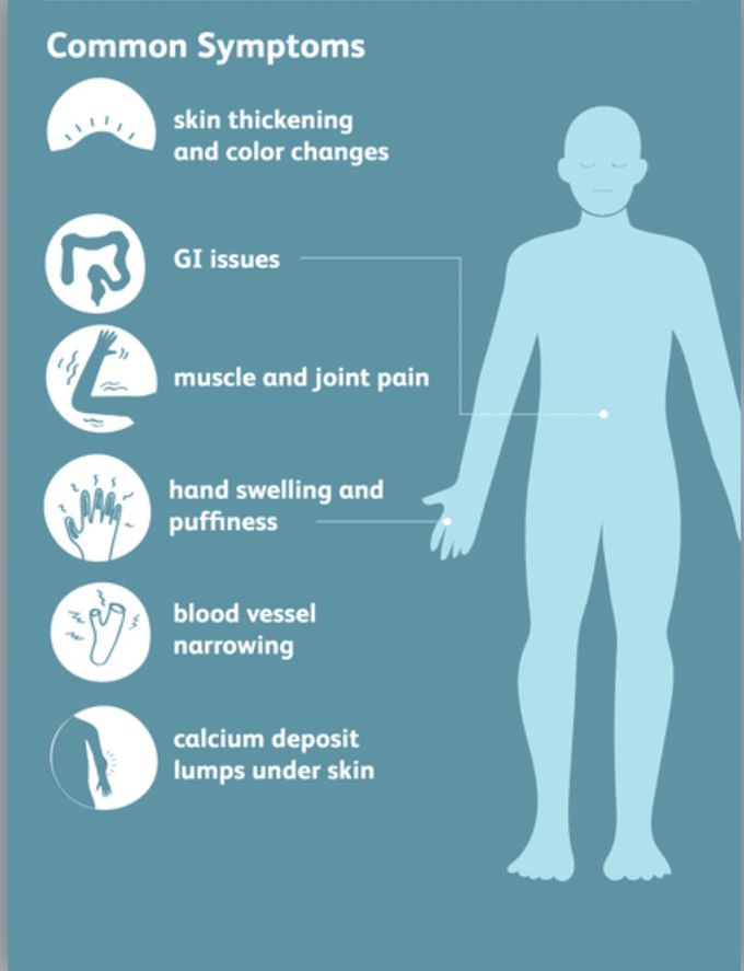 Scleroderma