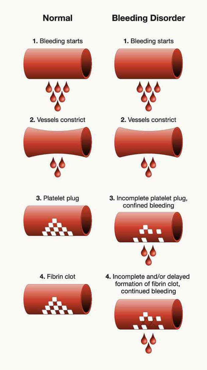 Blood clotting and related disorders