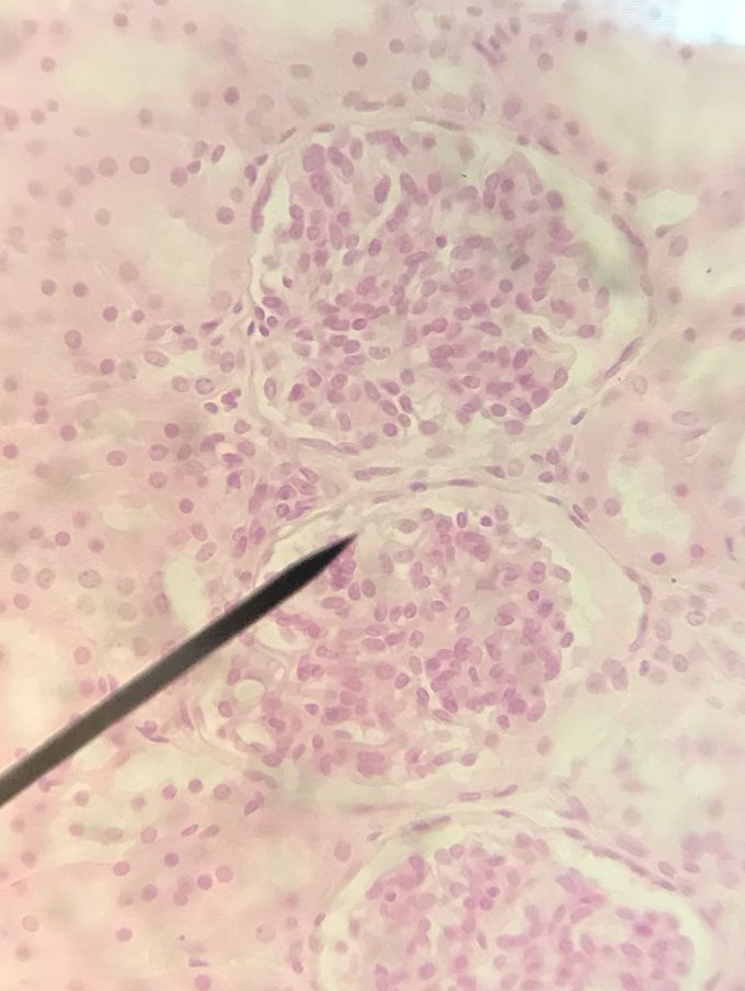 Glamorous Glomerulus