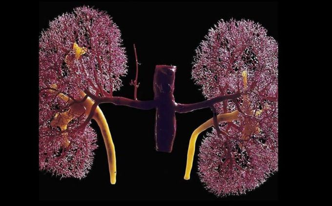 Kidney arteries casted with resin🔻