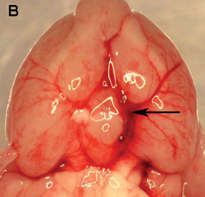 Phosphodiesterase 5 Inhibition Attenuates Cerebral Vasospasm and Improves Functional Recovery after Experimental Subarachnoid Hemorrhage