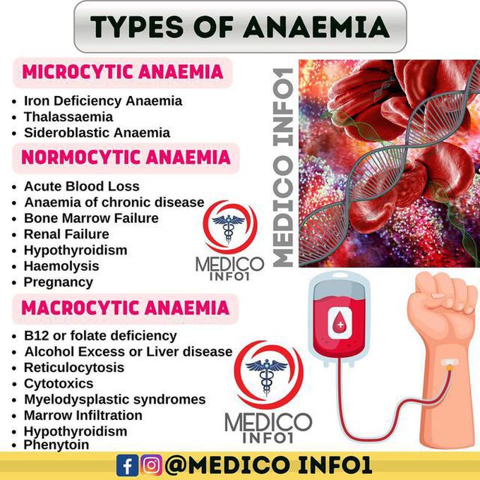 Anemia