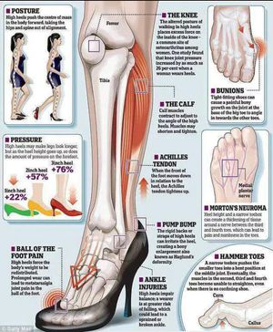 Leg structure - MEDizzy