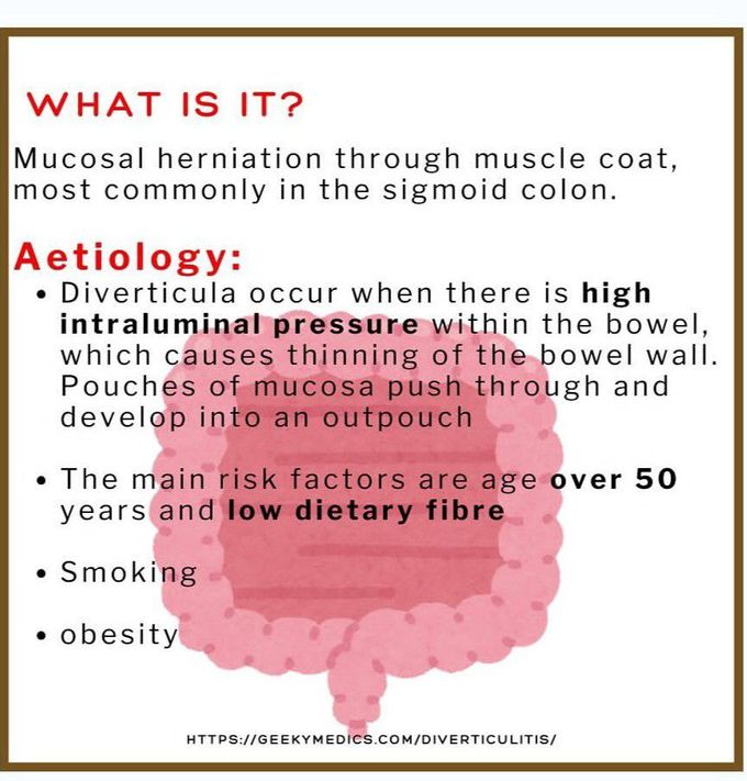 Diverticulitis I