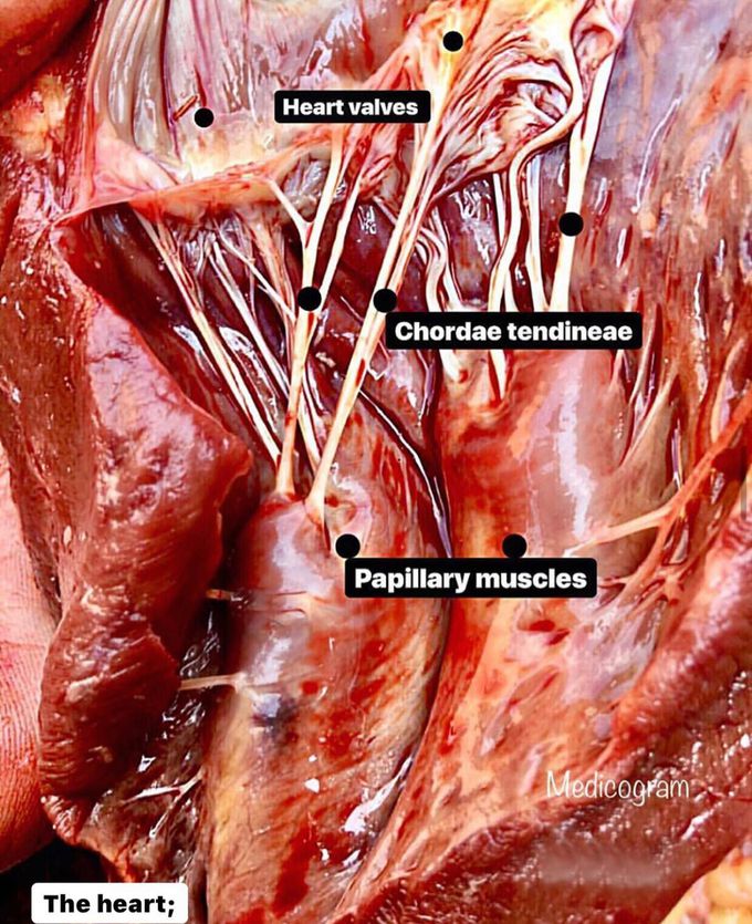 Papillary muscles & cordae tendineae (Heart strings) of the heart