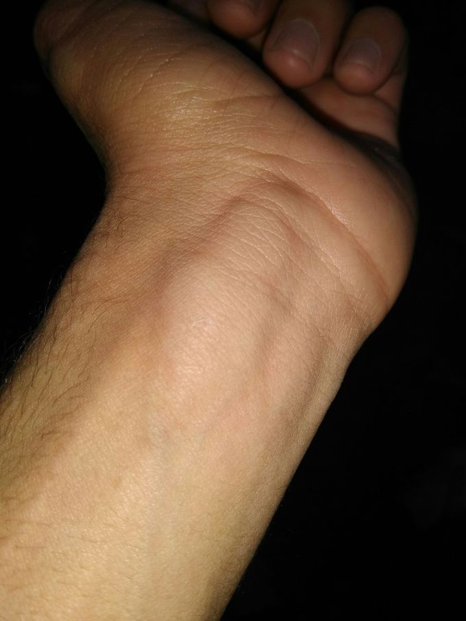 What is the diagnosis??