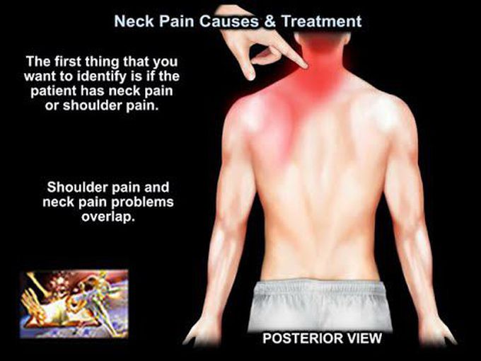 Neck pain