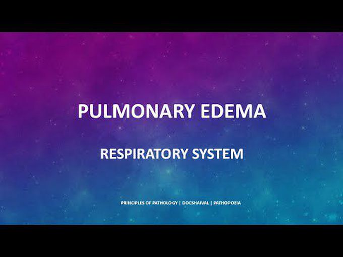 Brief review of Pulmonary Edema