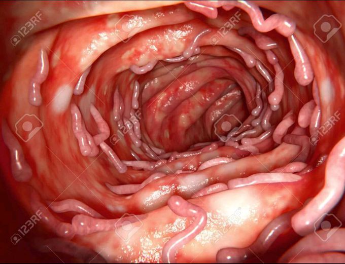 Diagnosis!!!!