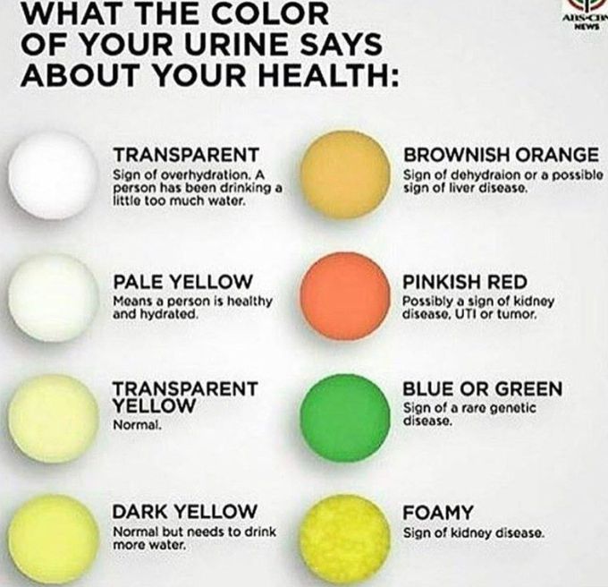 Urine Color Analysis