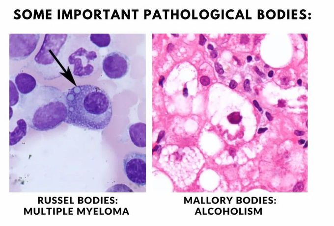 Pathology Bodies
