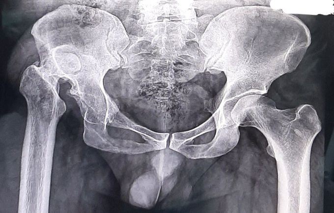 What's your diagnosis ^ _ ^