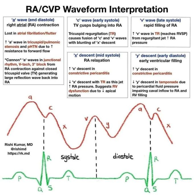 RA Waveform