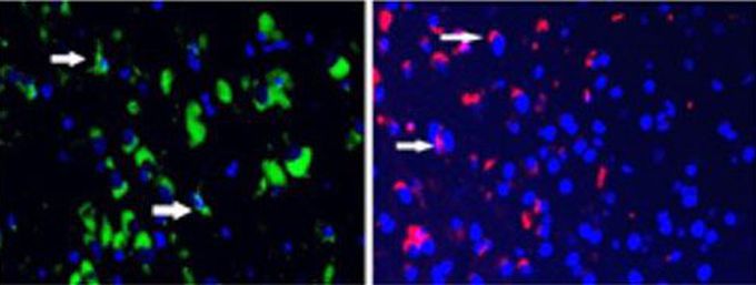 Breakthrough in stem cell therapy!