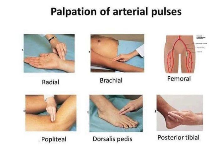 Palpation of arterial pulse