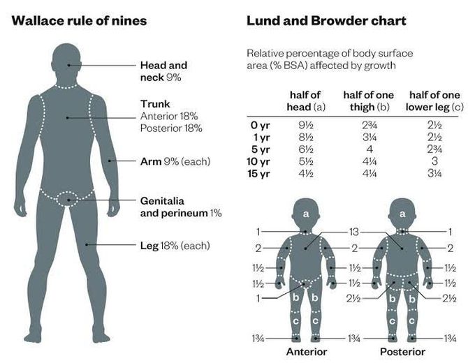 Wallace Rule of Nine and Lund and Browder chart