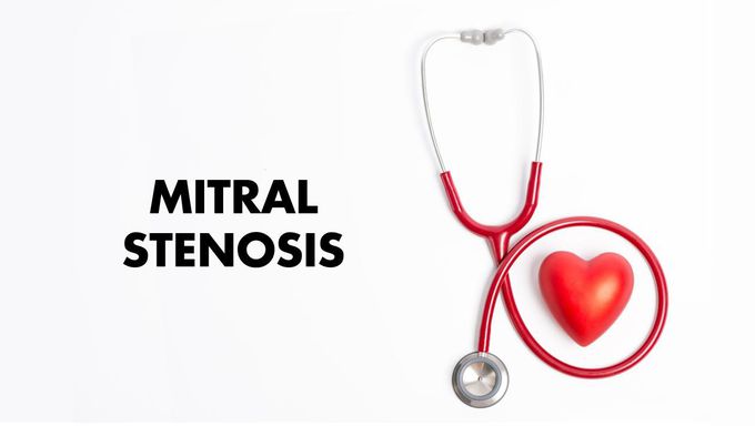 The Murmur of Mitral Stenosis