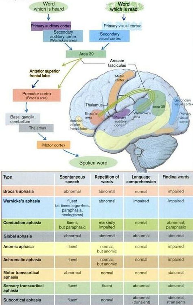 Types of Aphasia