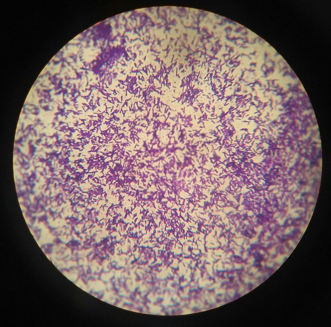 Gram's staining