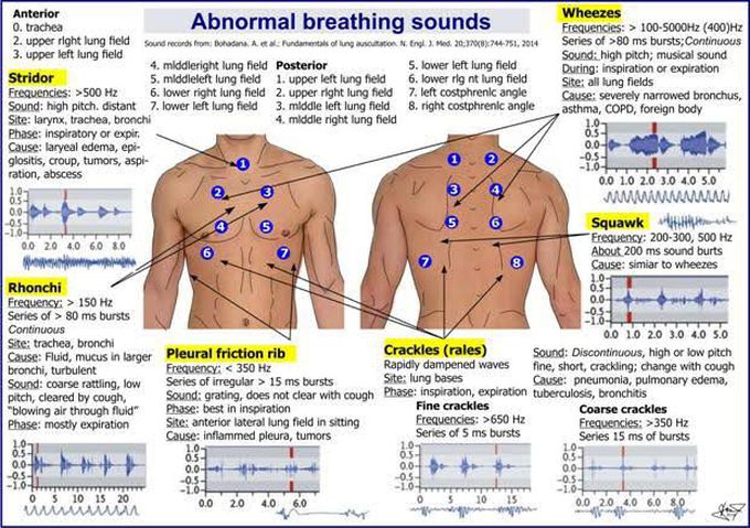 Respiratory terminology, breathing patterns, and lung sounds! Know your  abnormals!!! 🫁😮‍💨💨