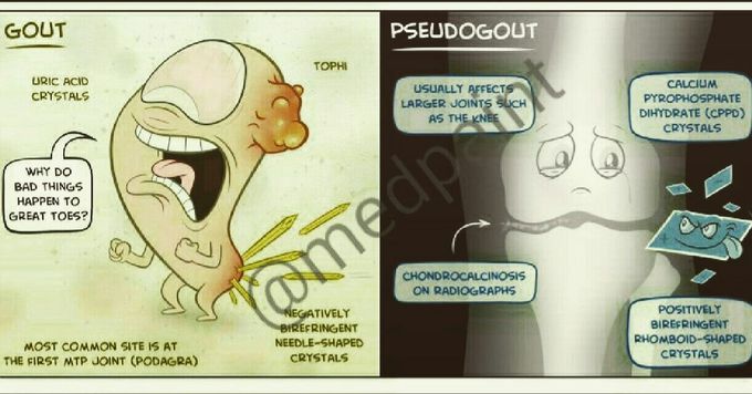 Difference between gout &pseudogoat