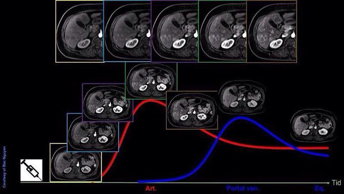 Liver imaging