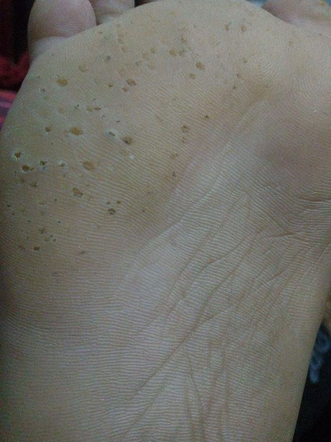 Whats diagnosis of this type of sign ?