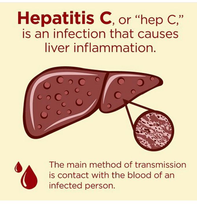 Hepatitis C