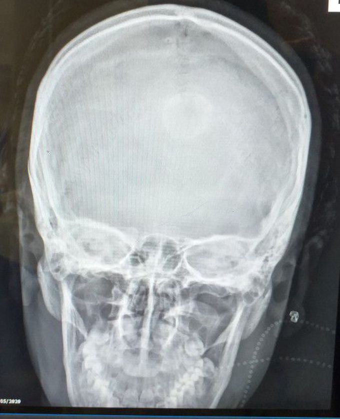 What is your diagnosis?