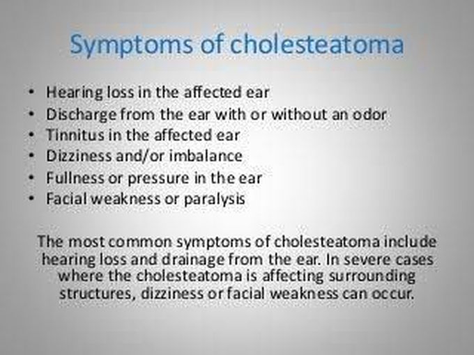 Symptoms of cholesteatoma