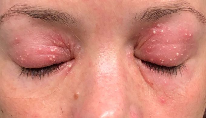 Pleae help diagnose