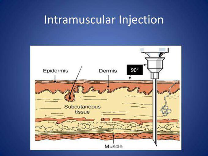 Which of the following is not suitable for intramuscular injection into patient
A) furosemide
B) diclofenac sodium
C) iron sucrose
D) a and b
E) none of above