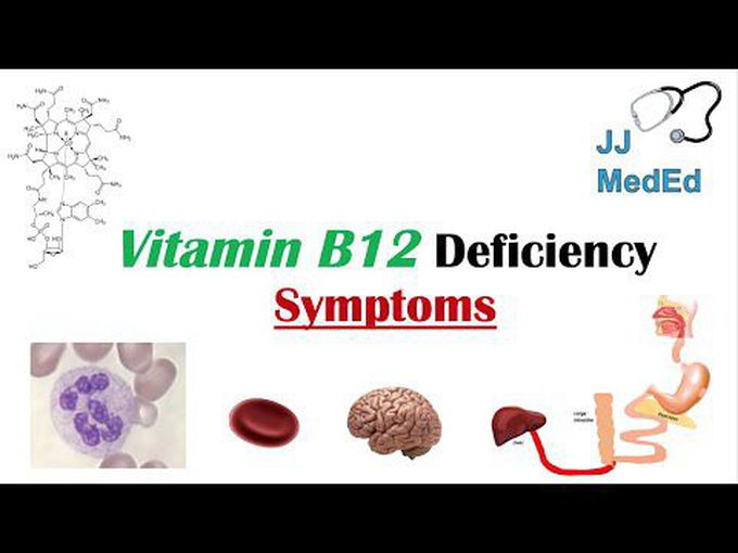 Descriptive review of Vitamin B12 Deficiency