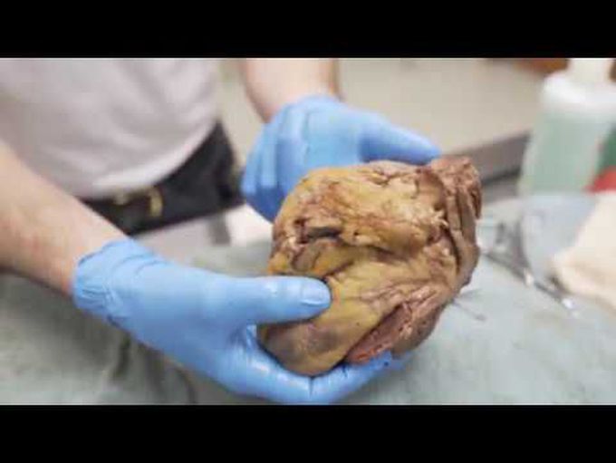 Heart Overview and Blood Flow