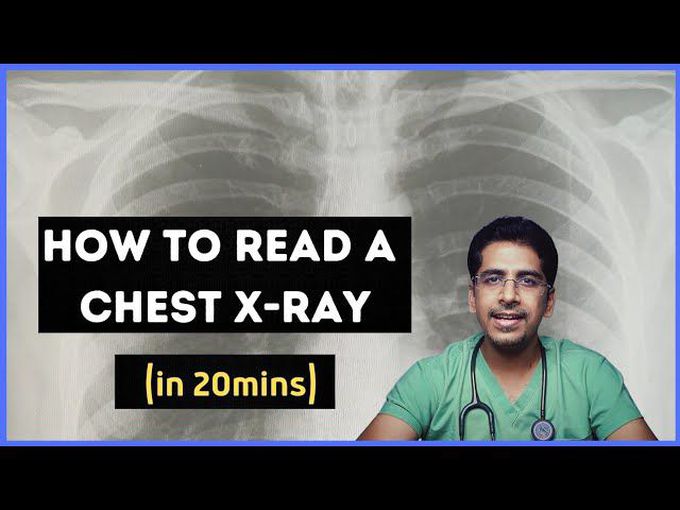 How to read a chest X-ray