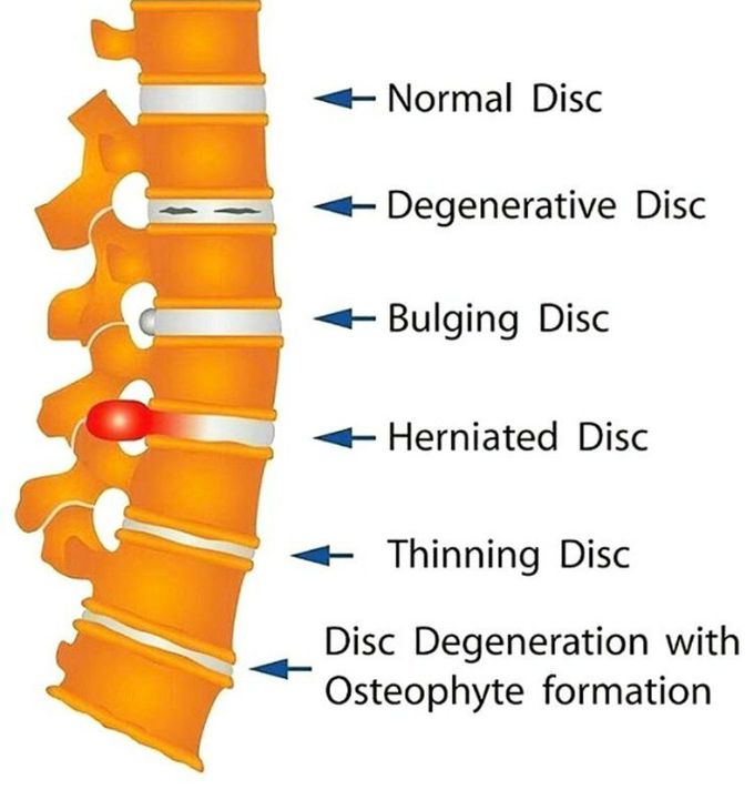 Bone Medizzy 