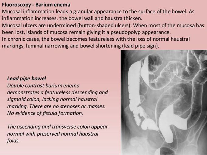 Barium series