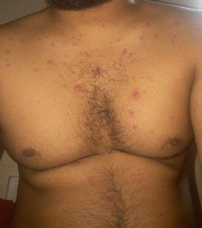 Diagnosis  and treatment