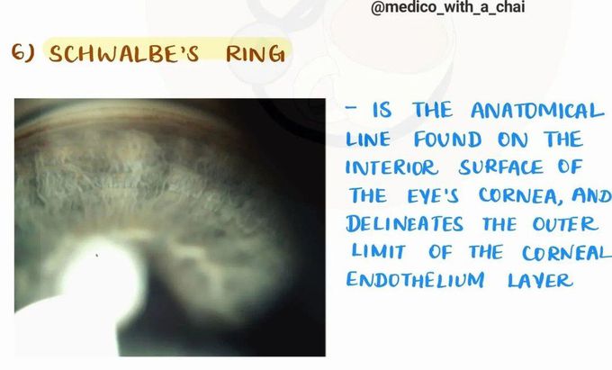 Schwalbe's Ring