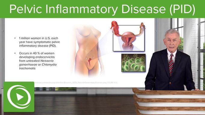 Pelvic Inflammatory Disease (PID) – Infectious Diseases | Lecturio