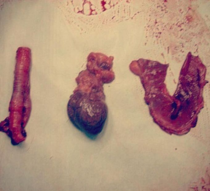 That's how doctors/medical students show their love