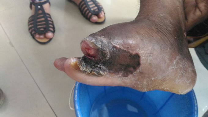 what is ur diagnosis