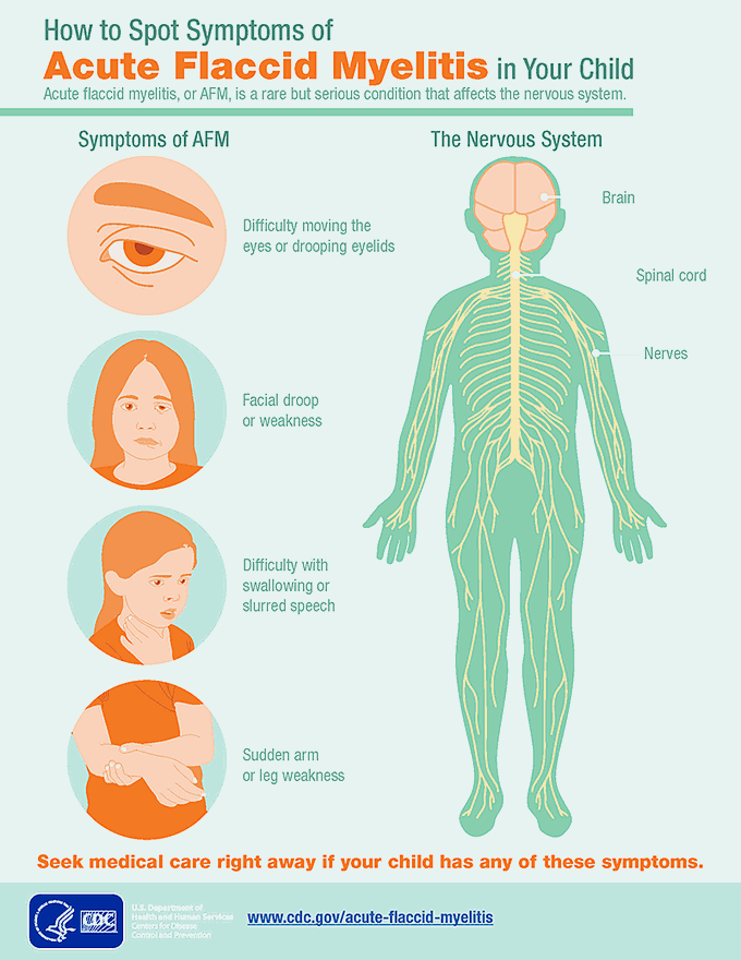 What are the symptoms of acute flaccid myelitis?