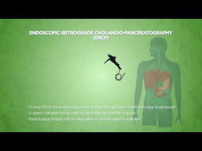 ERCP-Introduction